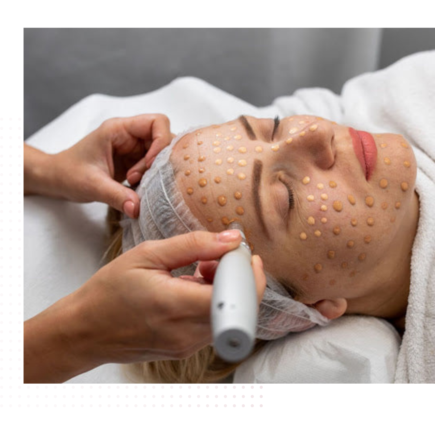 BB Glow In Scottsdale AZ | TGS Lab
