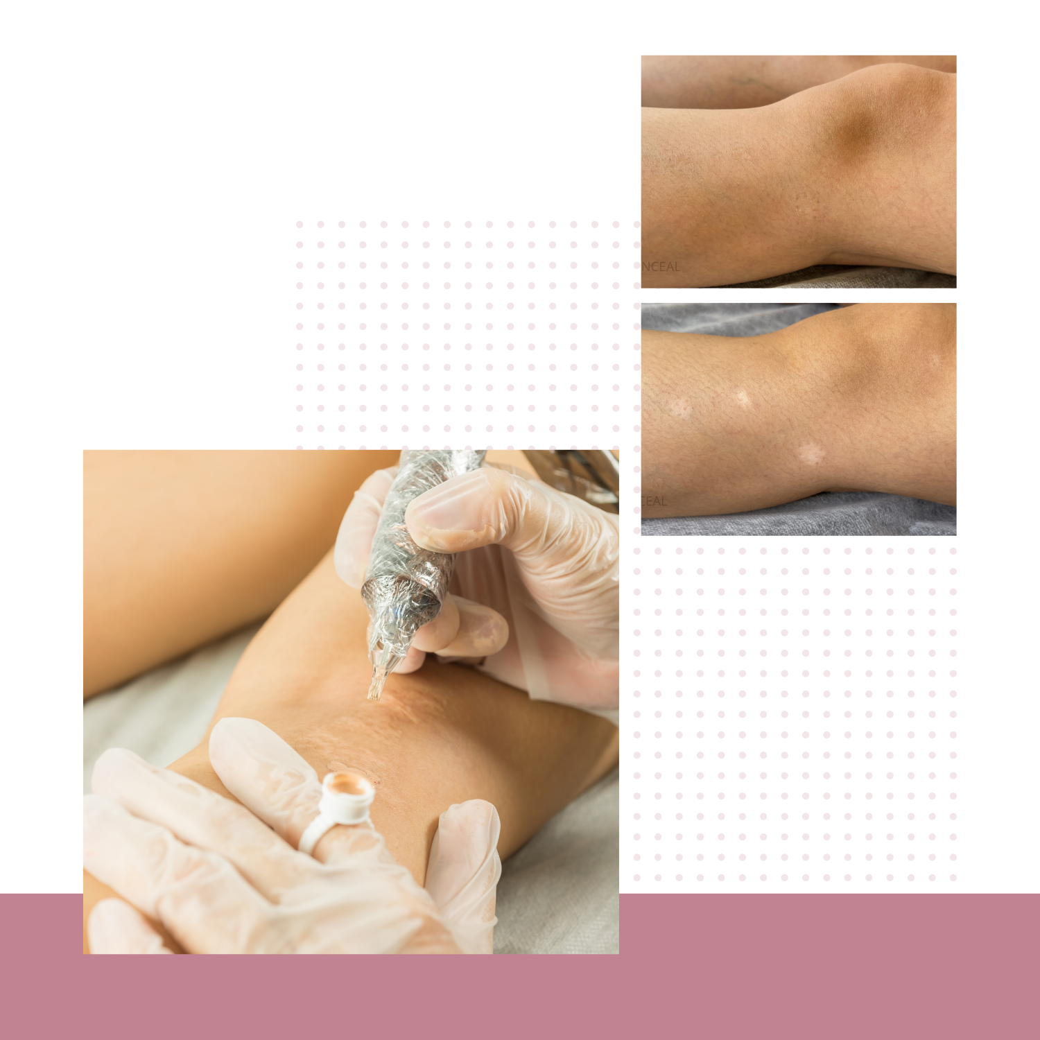 Paramedical Tattoo In Scottsdale AZ | TGS Lab