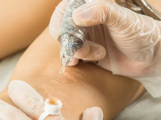 Everything You Need to Know About Paramedical Tattoos