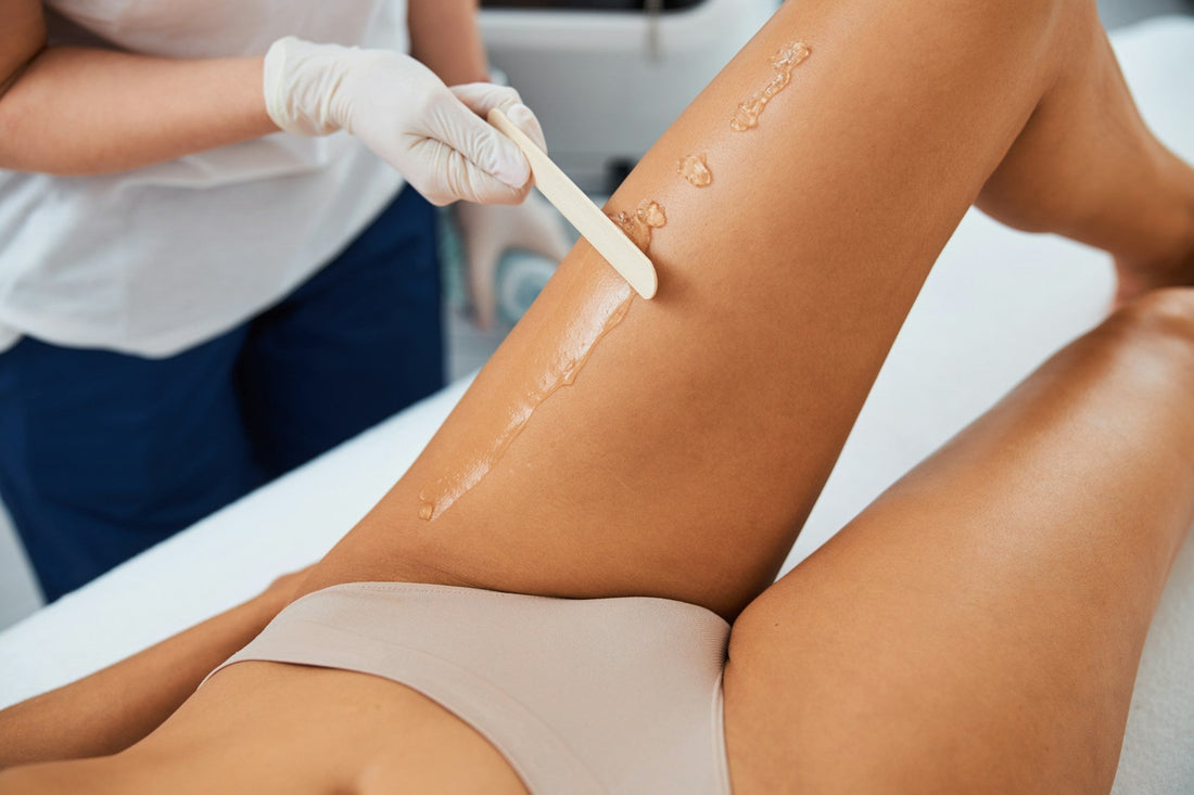  Stretch Mark Revision 