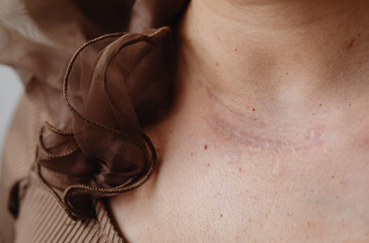 Understanding Inkless Scar Revision in Scottsdale