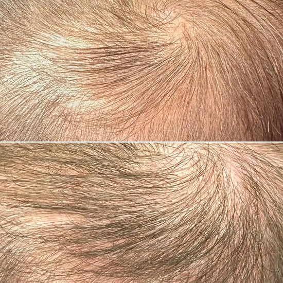 Close-up of hair texture before and after treatment