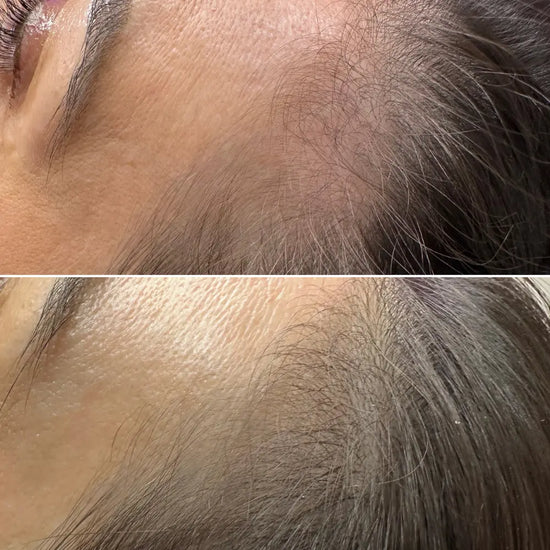 Close-up of a person's scalp before and after hair treatment.