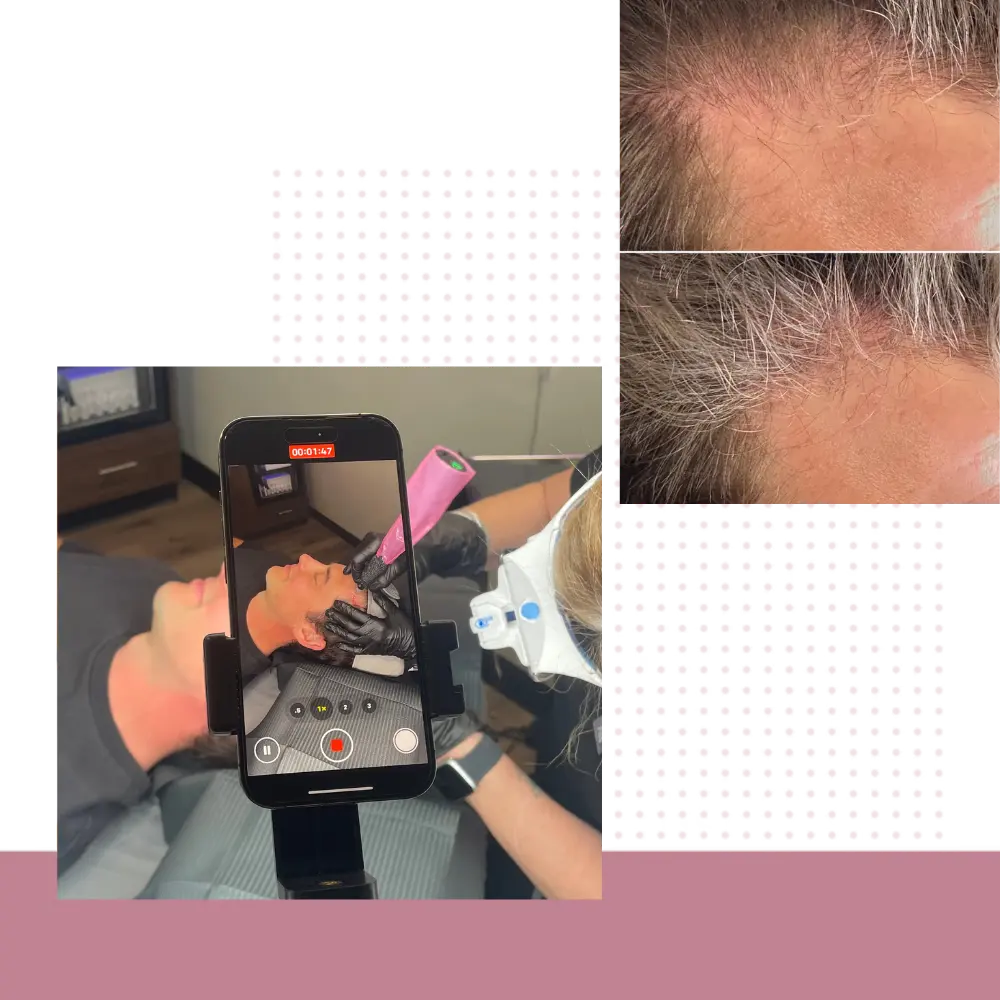 Hair Restoration Services In Scottsdale AZ | TGS Lab